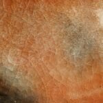 Photo Skin analysis